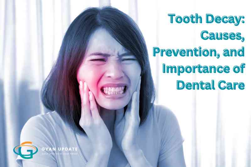 Understanding Tooth Decay: Causes, Prevention, and Importance of Dental Care